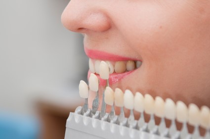 Teeth selection colour