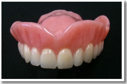 full dentures