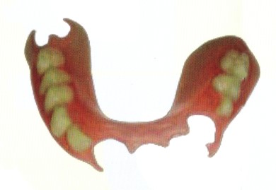 Flexible Partial Dentures