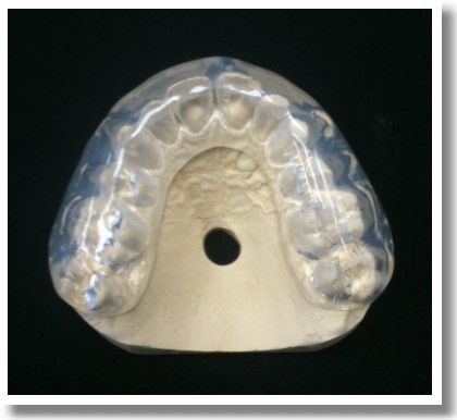Sports Mouthguards